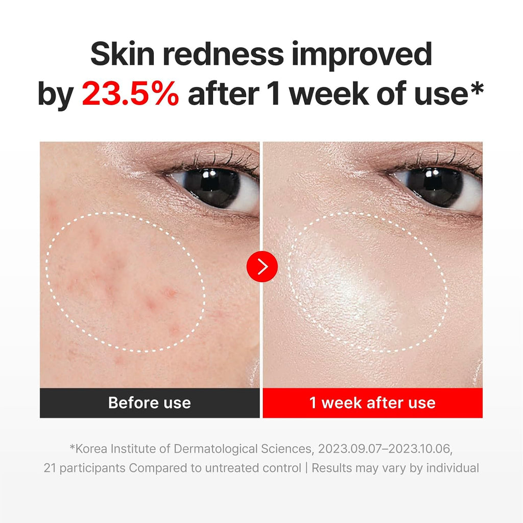 TECA Centella Asiatica Glow Face Cream Moisturizer, Hydrating, Firming, Smoother Even-Looking Skin, Helps Improve Skin Elasticity,Korean Skincare-AJZ