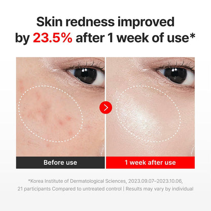 TECA Centella Asiatica Glow Face Cream Moisturizer, Hydrating, Firming, Smoother Even-Looking Skin, Helps Improve Skin Elasticity,Korean Skincare-AJZ
