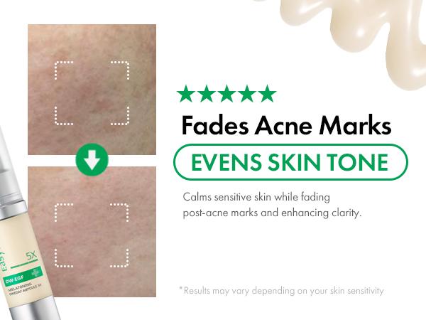 DW-EGF Melatoning Ampoule - Official Product Hydrating Skin Serum with Niacinamide and Glutathione for Uneven Skin & Visible Spots - Fast Absorbing Day and Night Ampoule Korean Skin Care-AJZ